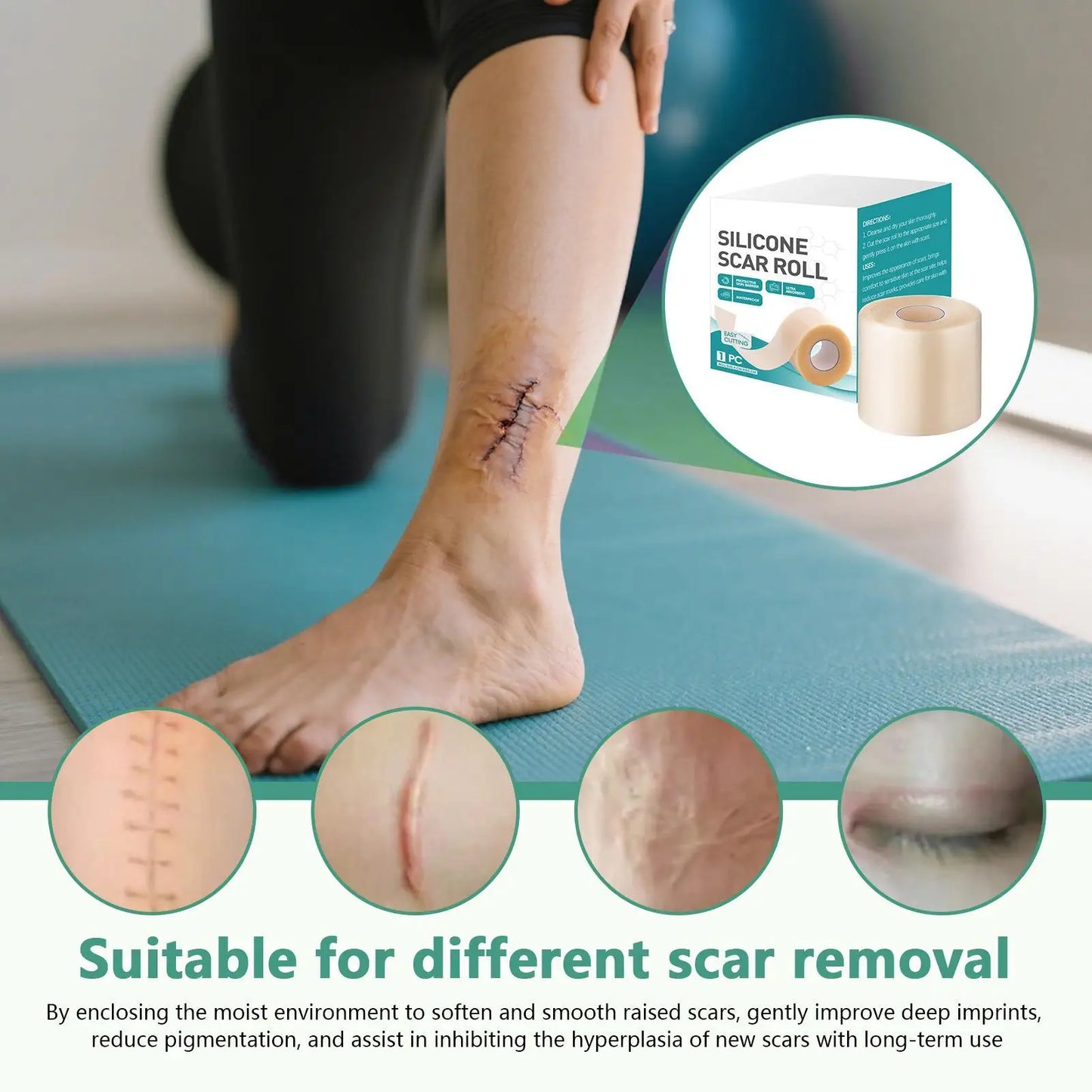 Silicone scar patch hydrocolloid roll self-adhesive ydrocolloid patch bandage highly absorbent for burn blister wound care